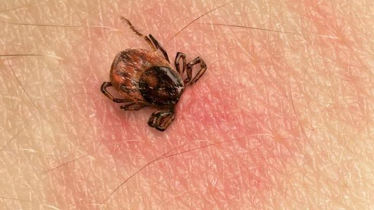 Was ist Tick, wie man versteht? Wie behandle ich Zeckenstiche? Was ist Tick, wie man versteht? Wie behandle ich Zeckenstiche?