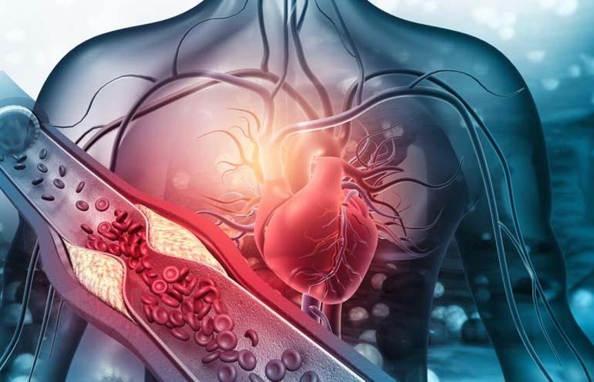 Das schlechte Cholesterinspiegel wirft Ohnmacht, aber ... nicht nur übergewichtig, sondern auch schwache Menschen in Gefahr eines Herzinfarkt